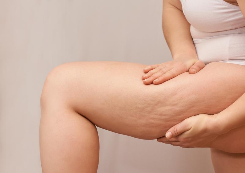 Naturalne składniki i dieta na cellulit